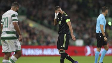 Real Madrid: Lesión de Benzema no es grave