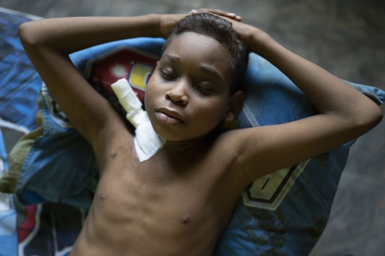 REP-GEN VENEZUELA-TRASPLANTES EN NIÑOS