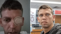 cubano recien llegado a eeuu con parole decide regresar a cuba tras sufrir una paralisis facial. ahora pide ayuda para regresar