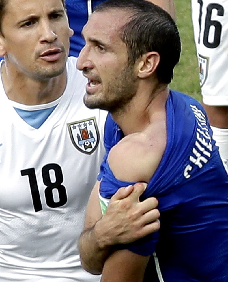 El italiano Giorgio Chiellini muestra el hombro donde dice que el uruguayo Luis Su&aacute;rez lo mordi&oacute; durante el encuentro entre Italia y Uruguay en la Copa del Mundo en Natal, Brasil, el 24 de junio de 2014. Chiellini opin&oacute; que la sanci&o