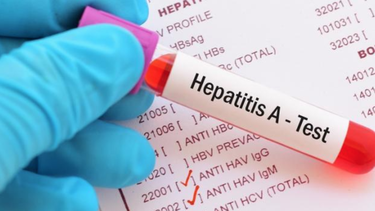 un brote de hepatitis en el condado broward ha puesto en alerta a la comunidad