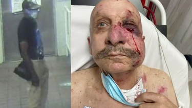 otro hispano es victima de una brutal golpiza a manos de un afroamericano en el metromover de miami