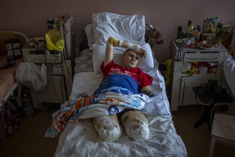 Anton Gladun, de 22 años, está acostado en el Hospital Third City, en Cherkasy, Ucrania, el 5 de mayo de 2022. Anton, un médico militar enviado el frente en el oriente de Ucrania, perdió ambas piernas y el brazo izquierdo en una explosión de mina el 27 de marzo. (AP Foto/Emilio Morenatti)
