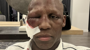 yordenis ugas no requiere cirugia en su ojo derecho y se prepara para volver al ring