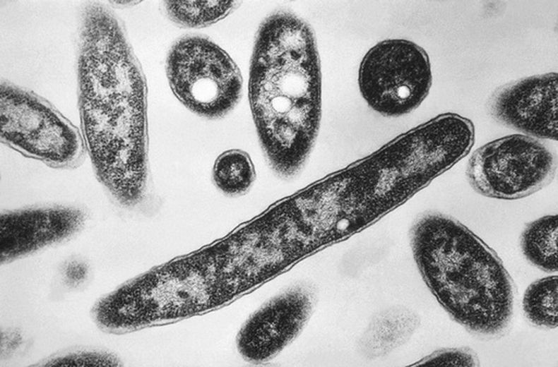 Imagen de microscopio tomada en 1978, entregada por los Centros de Control y Prevención de Enfermedades de Estados Unidos, que muestra la bacteria que causa el mal del Legionario. (Francis Chandler/CDC via AP)
