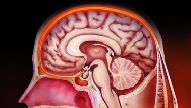 el lapiz gigante destacado por el mit que puede diagnosticar meningitis sin una puncion lumbar