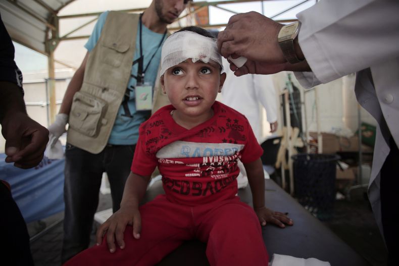 Un ni&ntilde;o palestino es atendido en el hospital kuwait&iacute; de Rafa por lesiones sufridas durante un ataque del ej&eacute;rcito israel&iacute; en la Franja de Gaza el domingo 3 de agosto de 2014. (Foto de AP/Khalil Hamra)