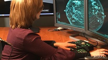 Estudio analiza mamografías en 3-D versus tradicionales