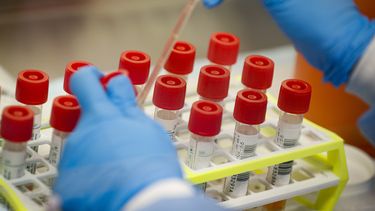 Pasos en falso demoran respuesta de EEUU al coronavirus