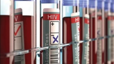 aumentan casos de vih en cuba