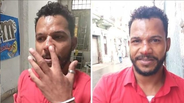 esto es no casualidad: un supuesto grupo de abakuas golpean a maykel osorbo en plena calle