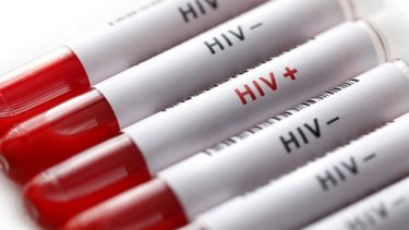 fda aprueba primer tratamiento contra el vih
