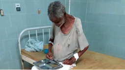 ancianos abandonados en el hospital provincial de camagüey: otra evidencia del colapso del sistema de salud cubano