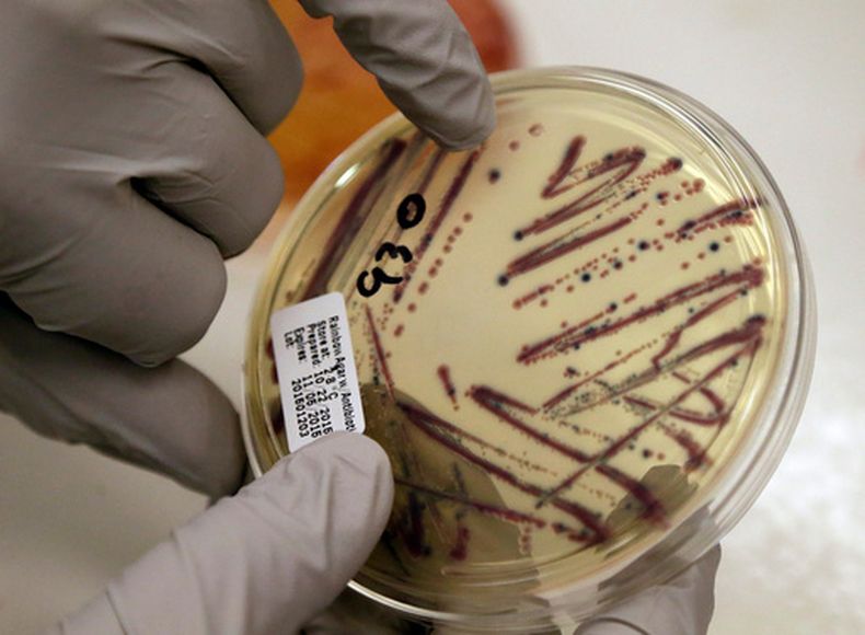 ARCHIVO - Un microbiólogo señala un cultivo aislado de E. coli en una placa de agar en el Departamento de Salud del Estado de Washington, el 3 de noviembre de 2015. (AP Foto/Elaine Thompson/Archivo)