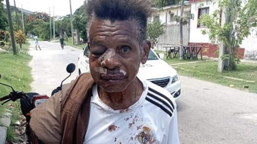 golpeado brutalmente un custodio en la habana durante el robo de tres motorinas