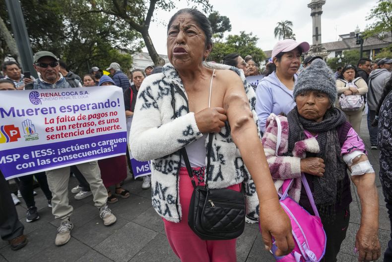 María Sambueza muestra un brazo con las consecuencias de haberse sometido a diálisis por años en una protesta de pacientes con afecciones renales fuera del palacio presidencial de Carondelet para pedir al gobierno que pague su deuda con las clínicas privadas para poder seguir recibiendo atención médica gratuita en Quito, Ecuador, Friday, Feb. 21, 2025. (AP Foto/Dolores Ochoa)