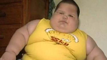 americateve | Misael es un niño brasileño que todavía pide estar en el regazo de su madre. Debido a un desorden genético, crece a razón de un kilo por mes. "Los médicos dicen que puede morir mientras duerme"