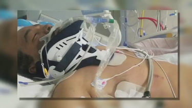 Continúa grabe el chofer involucrado en el accidente contra una patrulla policial