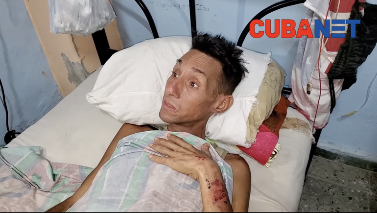 Desgarrador testimonio de cubano con VIH/Sida abandonado por el sistema de salud: Dice el médico que estoy en fase terminal