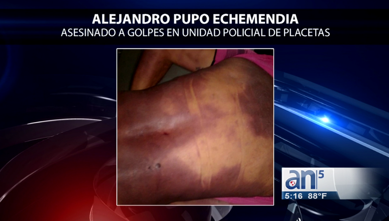 Napoles asesinan.png