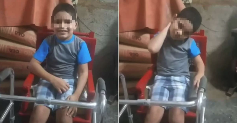 Desgarrador video donde un niño cubano pide ayuda: ´necesito medicamento para la escabiosis´