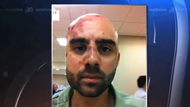 americateve | Un profesor de Miami- Dade College fue golpeado brutalmente a plena luz del día en el estacionamiento sur del campus de Kendall.