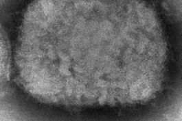 regulador ue sopesa autorizar vacuna para la viruela simica