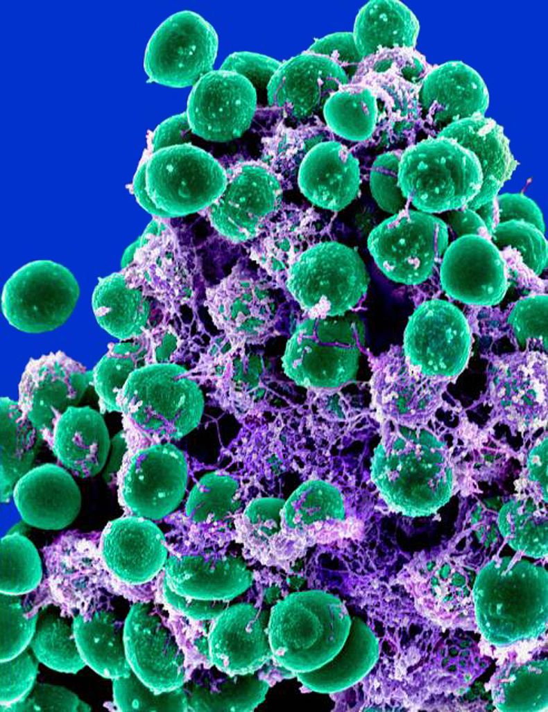 AMN-MED_RASTREANDO_MICROBIOS-0.jpg