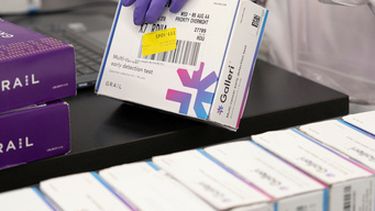 En esta imagen sin fecha, proporcionada por Grail Inc. el martes 22 de septiembre de 2026, aparece un empleado analizando una prueba Galleri para la detección del cáncer. (Grail Inc. vía AP)