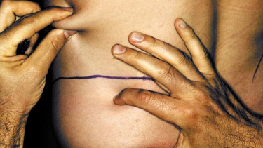 ¿cuales son las cirugias esteticas mas comunes entre los hombres?