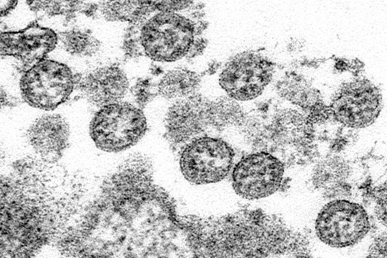 AMN-MED_CORONAVIRUS-NIÑOS-0.jpg