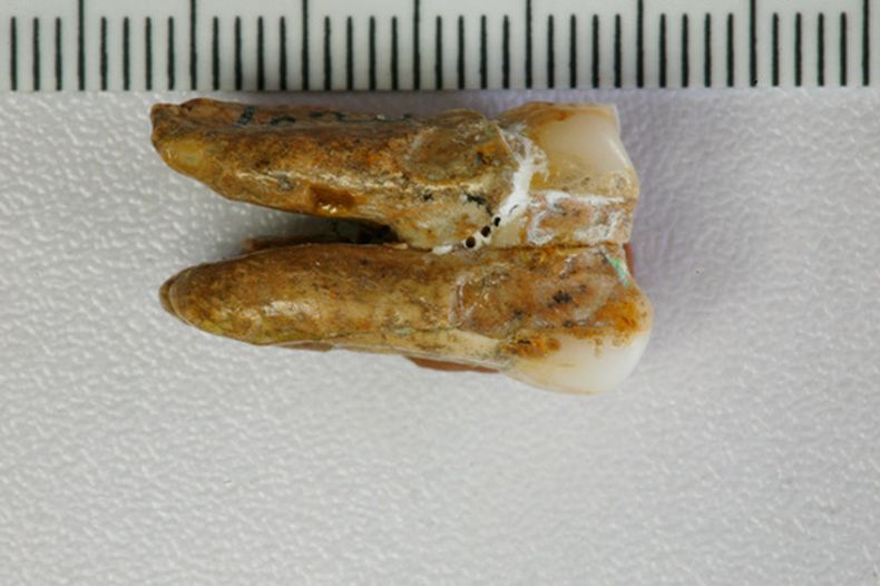 Esta imagen sin fecha, proporcionada por el Instituto de Paleontología de Vertebrados y Paleoantropología de la Academia China de Ciencias, muestra un diente antiguo hallado en el yacimiento arqueológico de Zhoukoudian, en el este de China. (Kai Zhou/Instituto de Paleontología de Vertebrados y Paleoantropología, Academia China de Ciencias vía AP)