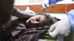 Una niña palestina herida en un ataque israelí sobre la Franja de Gaza recibe tratamiento en un hospital en Rafah, el 30 de octubre de 2023. (AP Foto/Hatem Ali)