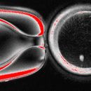 Foto sin fecha, suministrada por el Laboratorio Mitalipov Laboratory en la Universidad de Salud y Ciencia de Oregon, que muestra una imagen microscópica de un óvulo humano que contiene un núcleo tomado de una célula de piel. (Laboratorio Mitalipov via AP)