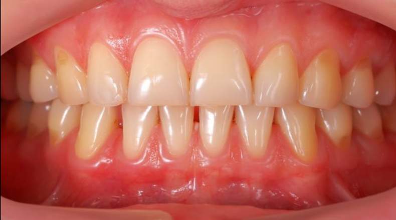 Screenshot (823).png