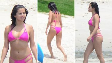 selena gomez anuncia que padece lupus, pero ¿en que consiste esta enfermedad?