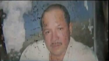 americateve | Hoy le amputaron la pierna al inmigrante nicaragüense que resultó atropellado por una mujer que se dio a la fuga.