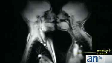 americateve | La ciencia no deja de sorprendernos y en esta ocasión han desnudado el placer que provoca el sexo a través de imágenes tomadas por resonancia magnética.