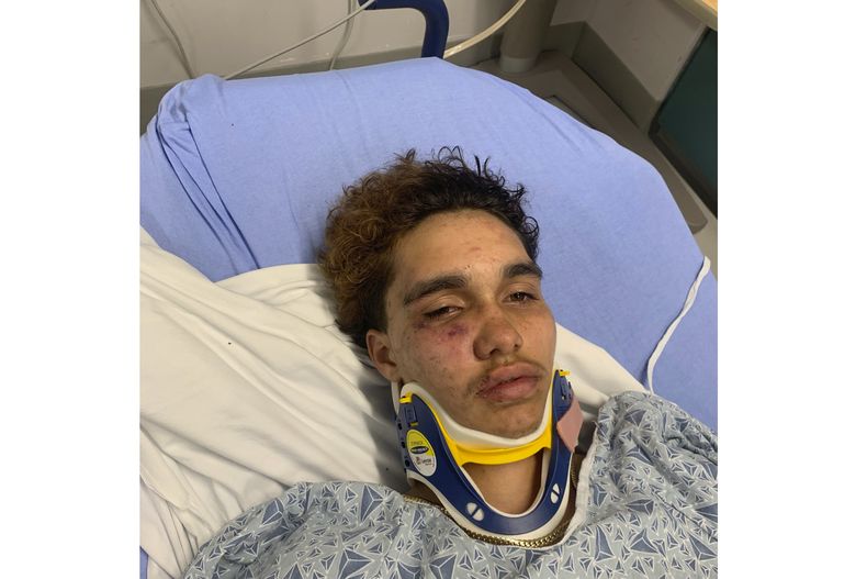 Jayden Tkaczyk, un joven transgénero, en el Addison Gilbert Hospital de Gloucester, Massachusetts, el 31 de agosto del 2024. Tkaczyk dice que fue atacado por otros estudiantes. (Steven Tkaczyk via AP)