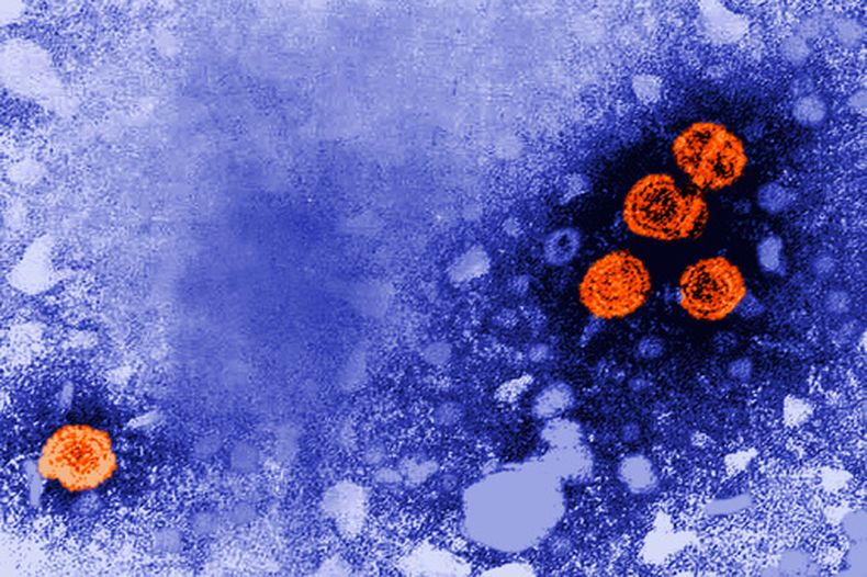 ARCHIVO - Esta imagen de microscopio de electrones de 1981 publicada por los Centros de Control y Prevención de Enfermedades de Estados Unidos mientras partículas del virus de la hepatitis B, indicadas en naranja. (Dr. Erskine Palmer/CDC via AP, Archivo)
