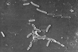 superbacterias causan mas de 1,2 millones de muertes
