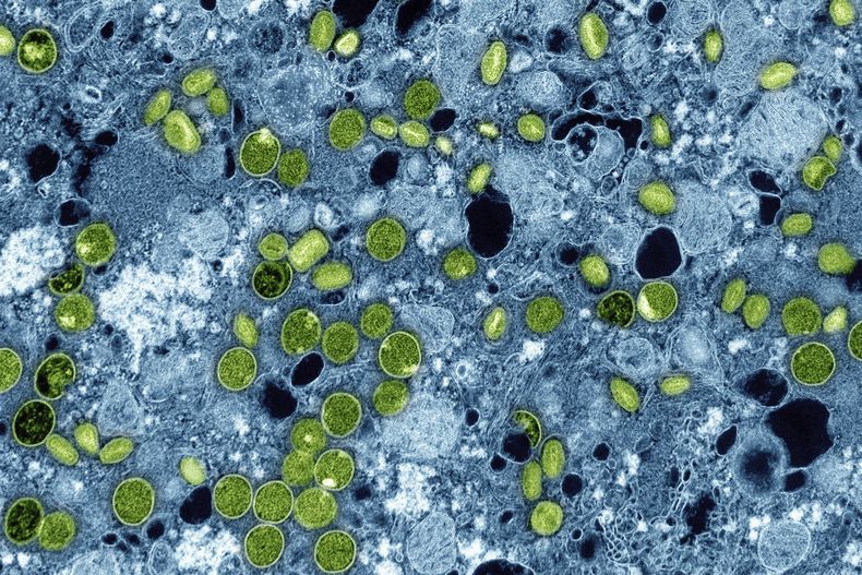 ARCHIVO - Esta imagen coloreada de microscopio electrónico proporcionada por el Instituto Nacional de Alergias y Enfermedades Infecciosas en 2024 muestra partículas del virus de la viruela, de color verde, encontradas dentro de células cultivadas infectadas, de color azul. (NIAID vía AP, Archivo)