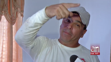 cubano de miami  termina herido tras enfrentarse a un ladron que entro en su casa