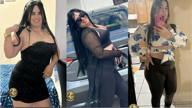 tragedia en miami: madre cubana pierde la vida tras una cirugia estetica.. sus dos hijos quedaron en cuba