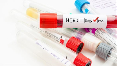 nueva esperanza: el virus del vih desaparece de la sangre de un paciente