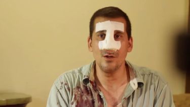 antonio rodiles relata el brutal arresto que lo llevo a un salon de operaciones