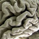 Cambios en estilo de vida podrían evitar mal de Alzheimer