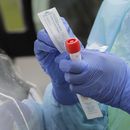 3 de cada 4 hospitales en EEUU tienen casos de coronavirus