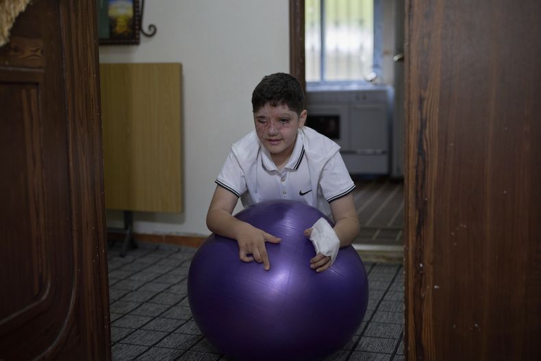 Ali Abbas, de 11 años, quien resultó herido en el ataque con bípers contra Hezbollah llevado a cabo por Israel el 17 de septiembre de 2024, juega en la casa de sus padres en la aldea de Barish, en el sur del Líbano, el lunes 28 de abril de 2025. (AP Foto/Hassan Ammar)