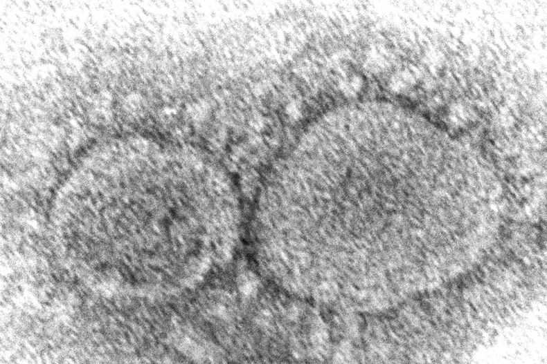 AMN-MED AP EXPLICA-CORONAVIRUS-ORIGEN